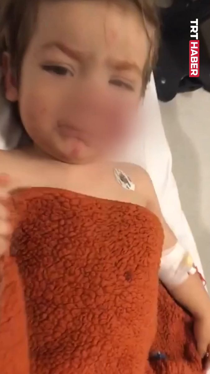 Ankara'da İki Kardeşi Yaralayan Pitbull'un Sahibi Tutuklandı