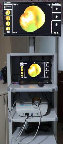 Afyonkarahisar'a Prematüre Bebekler İçin Kritik Göz Tarama Cihazı