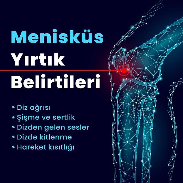 Denizli Denipollife Hastanesi: Menisküs Yırtıklarına Karşı Bilgilendirme ve Destek