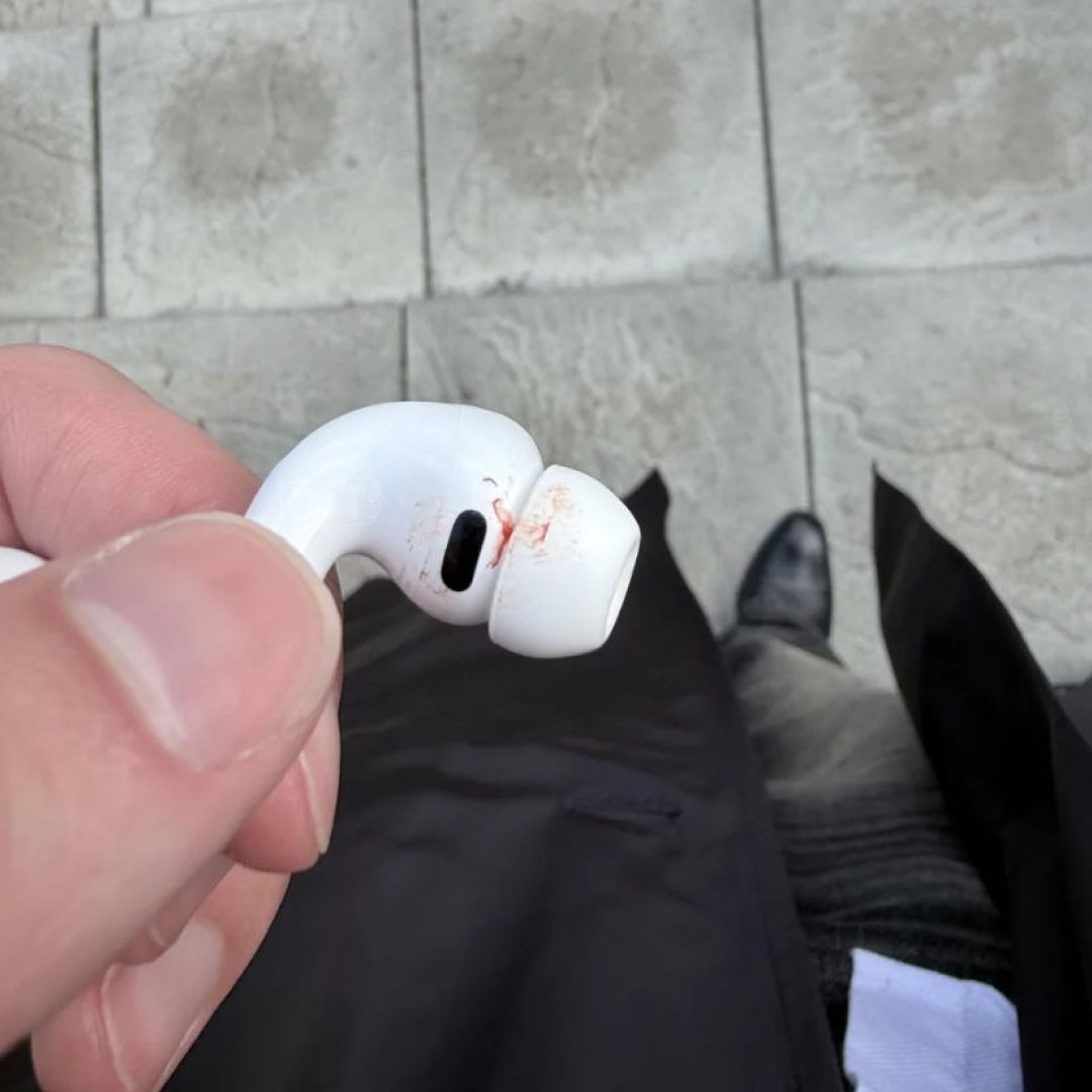 Yeni AirPods Kullanıcıları Rahatsız Etti: Kulak Ağrısı Şikayetleri Arttı